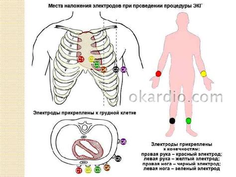 Техника проведения ЭКГ исследования