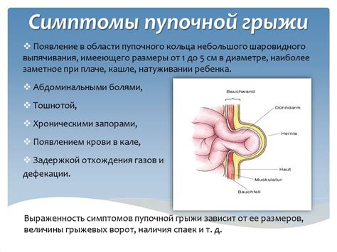 Типичные симптомы бобовидных грыж