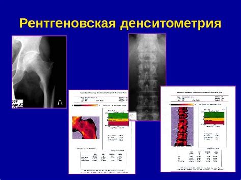 Толщина и плотность костей