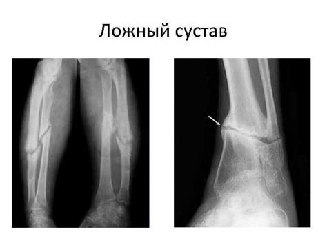 Травматические повреждения и контузии