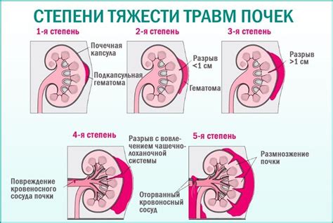 Травма почек