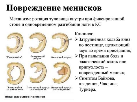 Травмы и повреждения коленного сустава