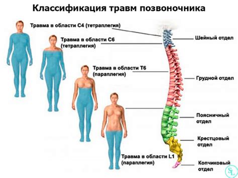 Травмы спинного мозга и возникновение параличей