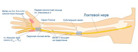 Туннельный синдром локтевого нерва и кисты канала Гаяона