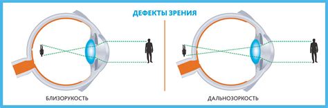 Увеличение ближнего зрения и его влияние на глаза