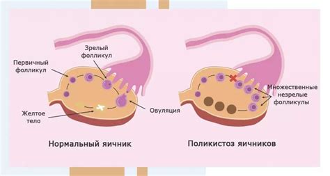 Увеличение живота