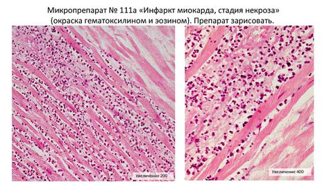 Увеличение кровообращения