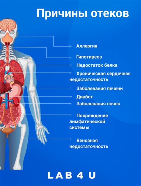 Узнайте причины отечности