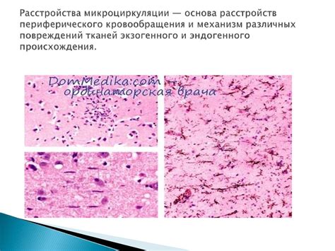 Улучшение микроциркуляции и лимфодренаж