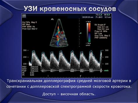 Ультразвуковые методы диагностики недостаточности сердца