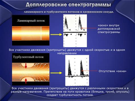 Ультразвуковые методы определения