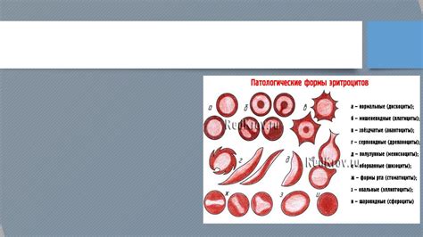 Уменьшение количества эритроцитов