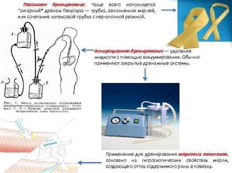 Уровни и дренирование