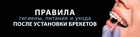 Условия питания при использовании брекетов