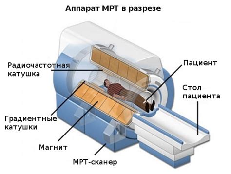 Устройство аппарата Илазарова