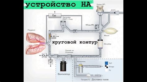 Устройство аппарата Невотон