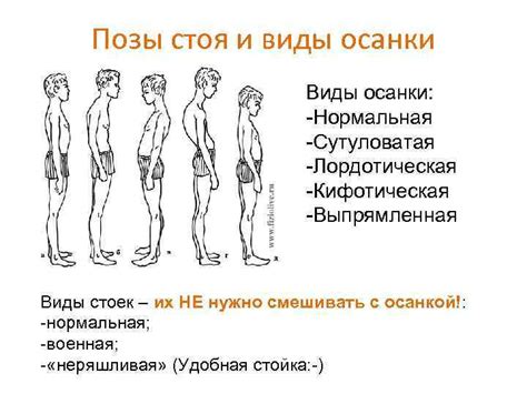 Ухудшение позы и осанки