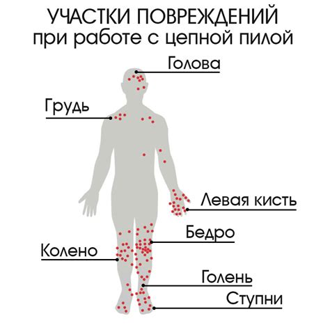 Участки тела, которые чаще всего подвержены укусам комаров