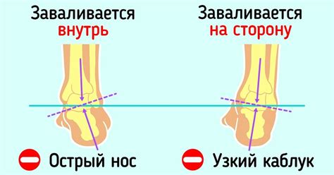 Учитывайте особенности своей стопы