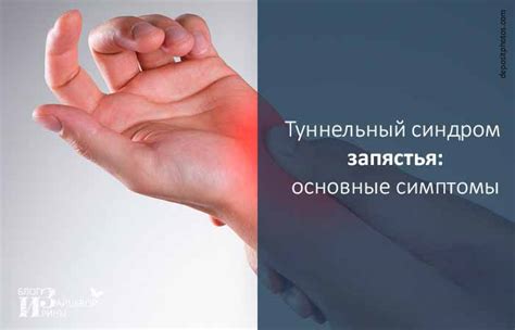 Учтите особенности запястья