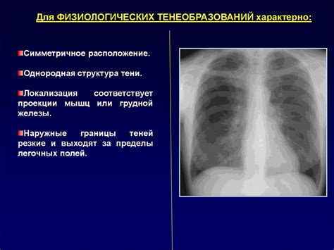 Фжел в патологии дыхательной системы