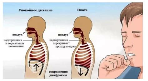 Физиологические причины появления икоты