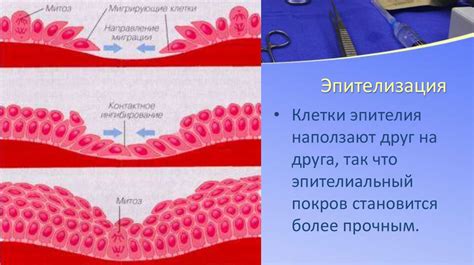 Физиологический процесс заживления