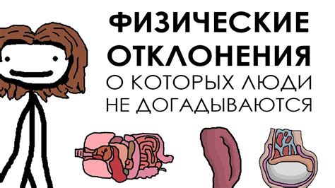 Физические отклонения