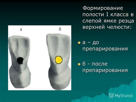 Формирование верхней части шлепков