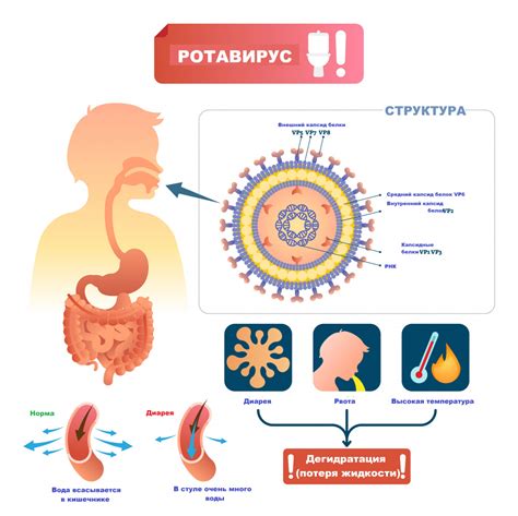 Характерные симптомы ротовируса