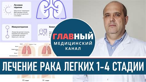 Химиотерапия для 4 стадии рака: методы и последствия