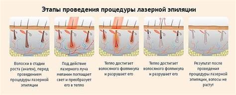 Часто задаваемые вопросы о процедуре эпиляции картриджным воском