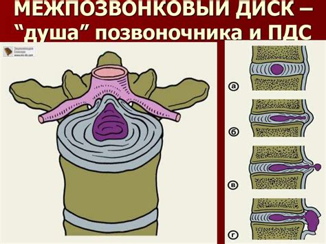 Частые заблуждения и ошибки диагностики крепатуры