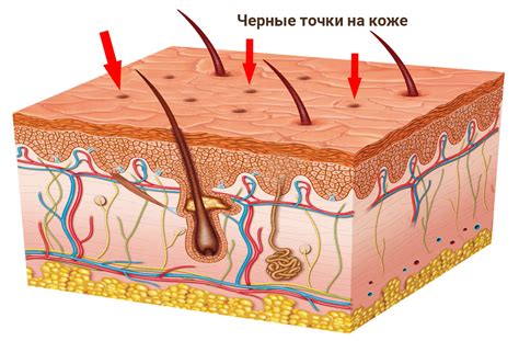 Черные точки: проблема и решение