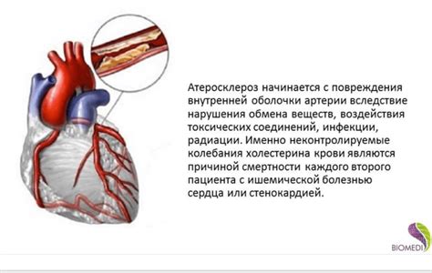 Чистые сосуды у абстинентов: причина и влияние