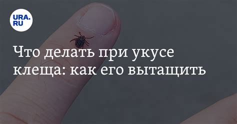 Что делать при укусе клеща: как правильно поступить