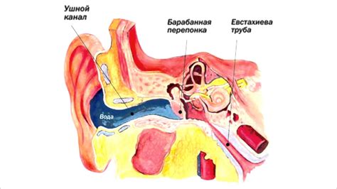 Что может вызвать затор в ухе?