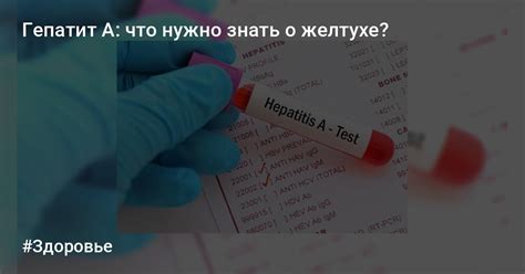 Что нужно знать о желтухе у взрослых и ее лечении