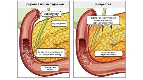 Что приводит к образованию мужского живота?