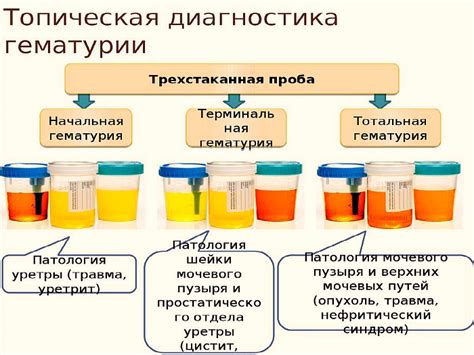 Что такое гематурия?