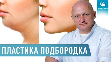 Что такое гипогенезия подбородка?