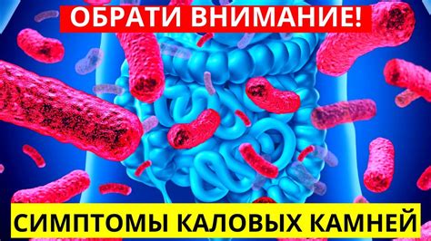 Что такое каловые камни и как с ними бороться?