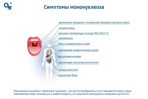 Что такое мононуклеоз и как он передается?