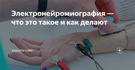 Что такое электронейромиография?