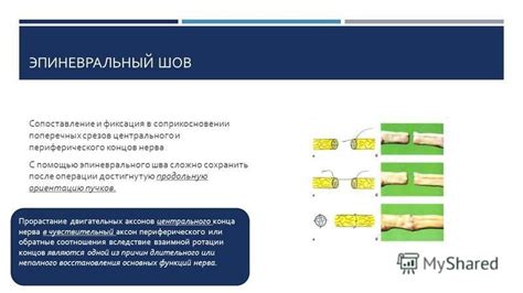 Шаг 3: Окончание связывания и фиксация шва