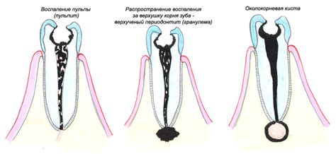 Экологическое лечение фолликулярной кисты