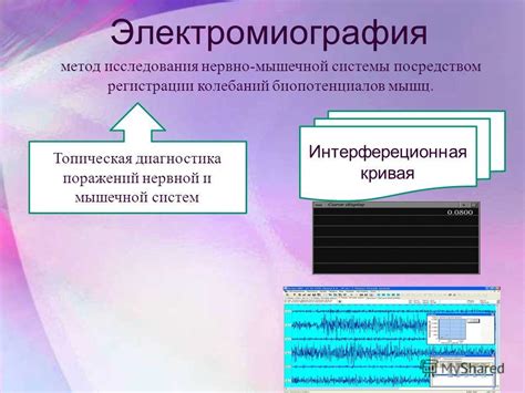 Электромиография и электрическая стимуляция нервно-мышечной системы - ММС-клиника