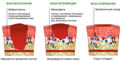 Этапы восстановления кожи после ожога