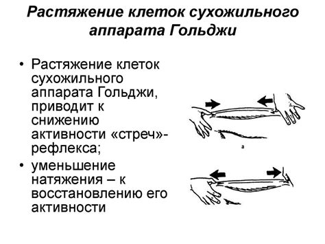 Этапы использования бугеля