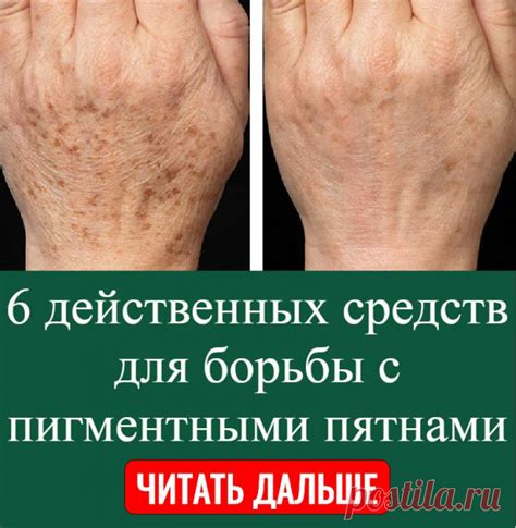 Эффективные методы для борьбы с пятнами ручки